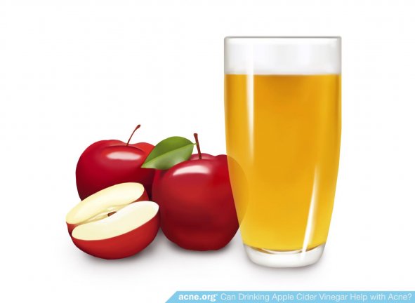 Apples Next to Apple Cider Vinegar in Glass
