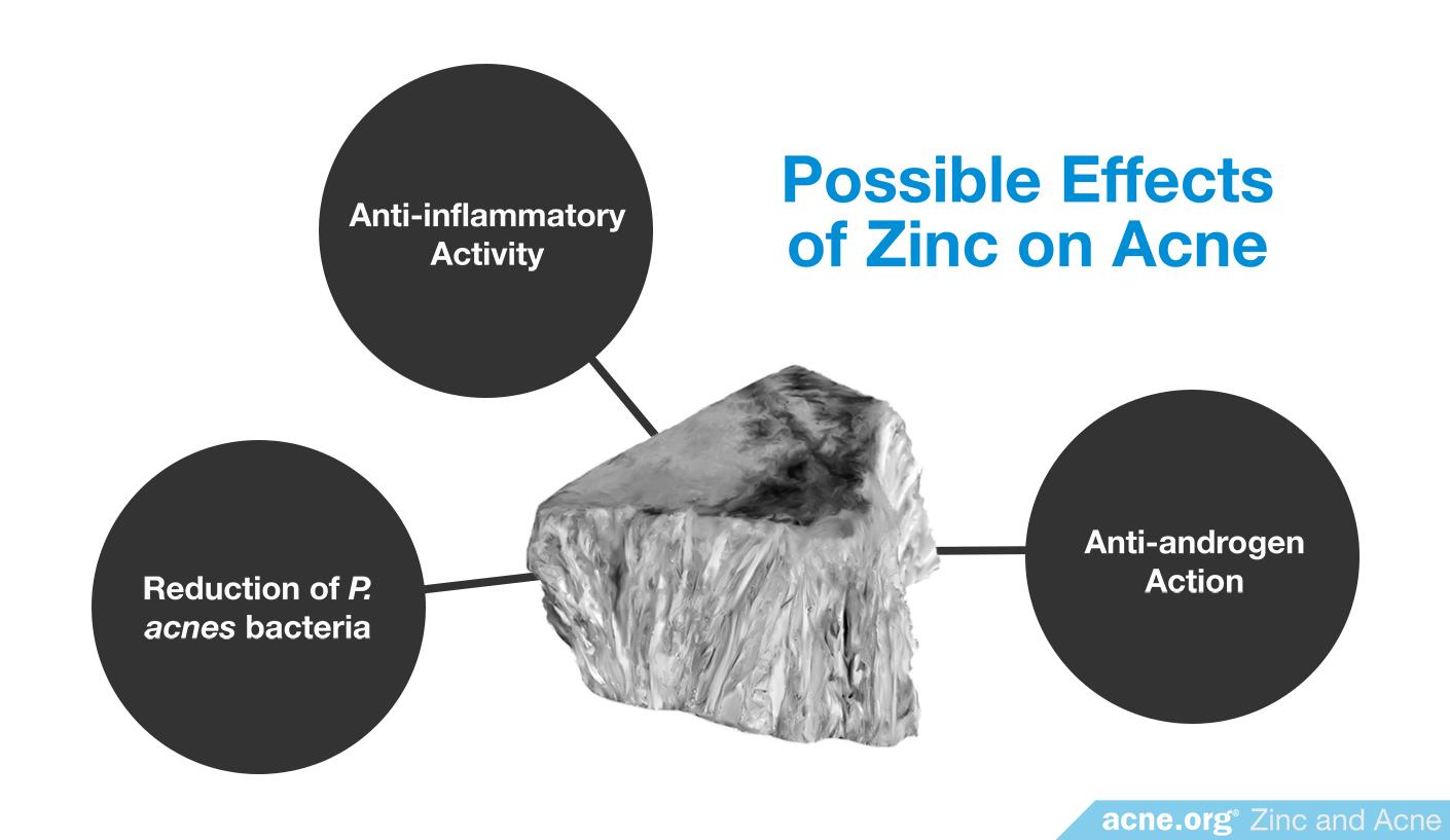 Zinc and Acne Overview