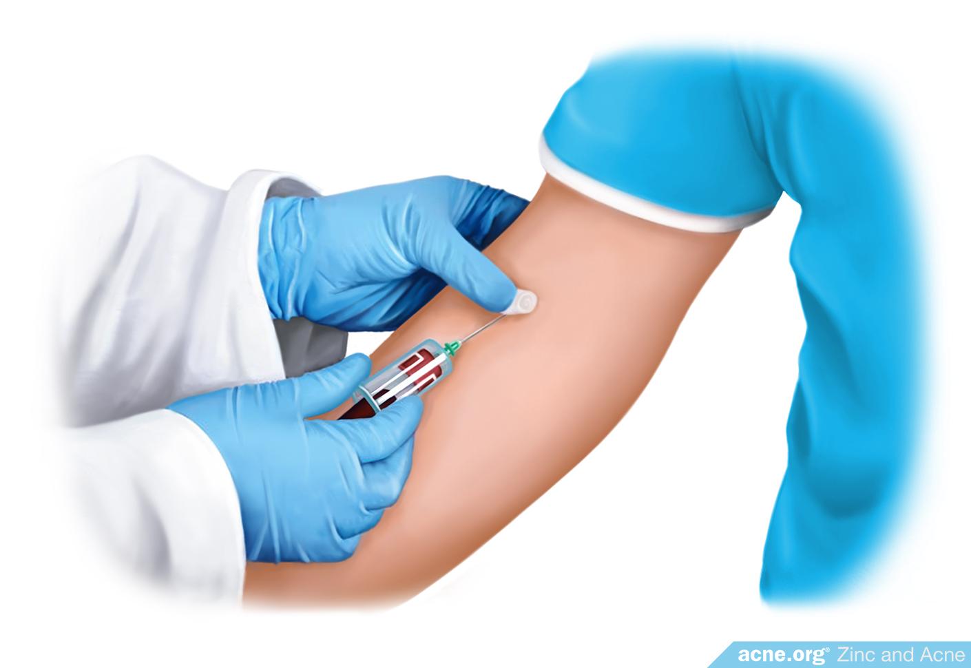 Blood Test for Zinc Levels