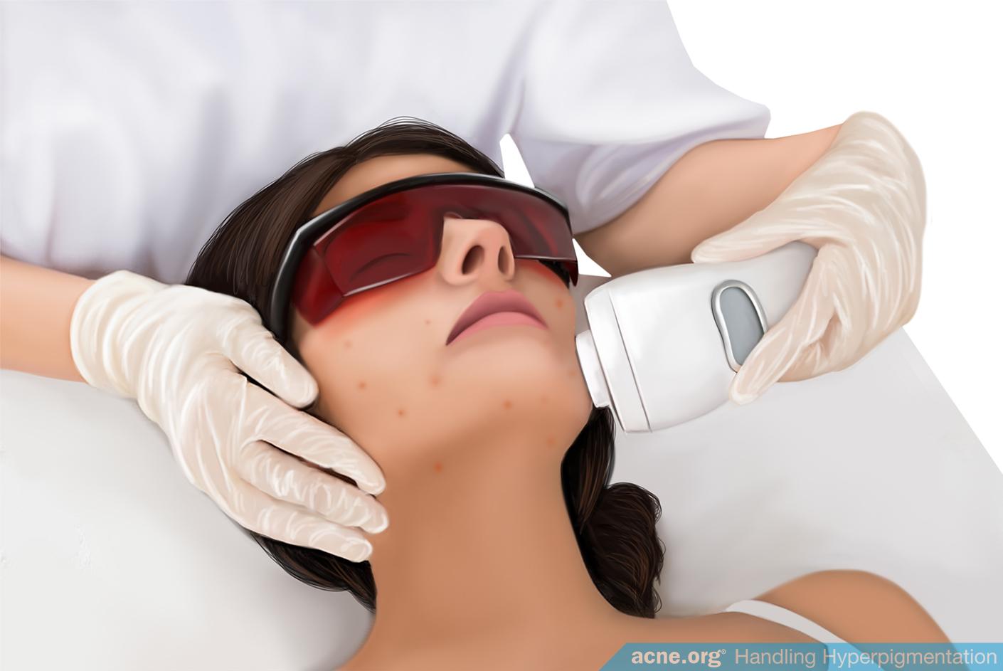 Laser Therapy