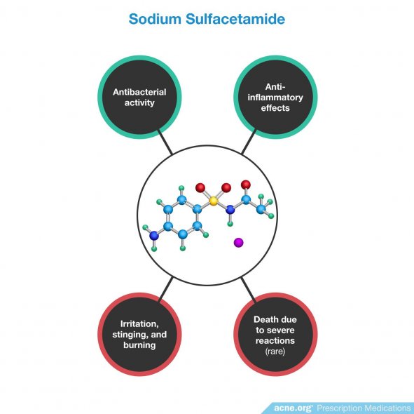 Sodium Sulfacetamide Effects/Side Effects