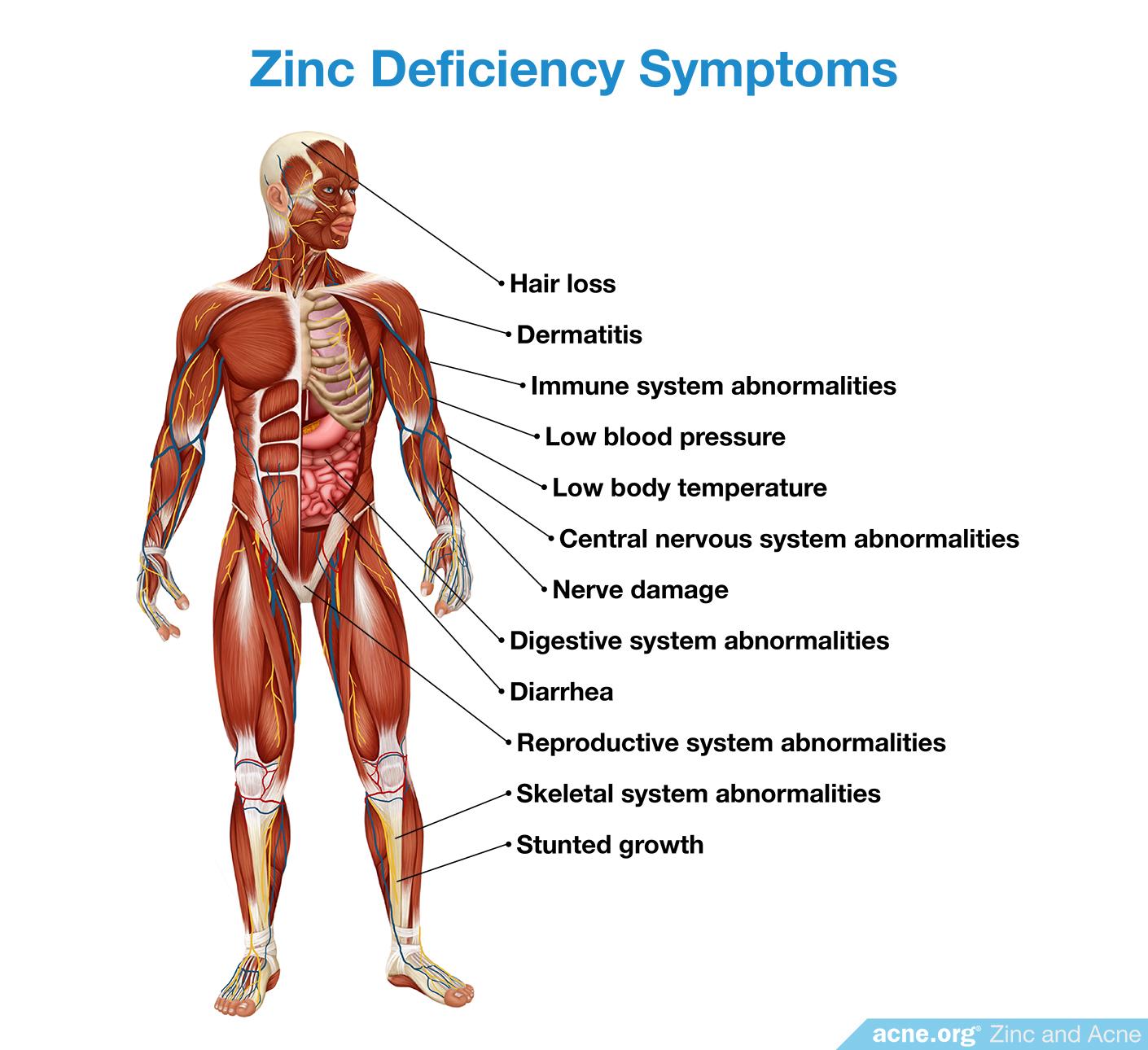 Zinc Deficiency Symptoms