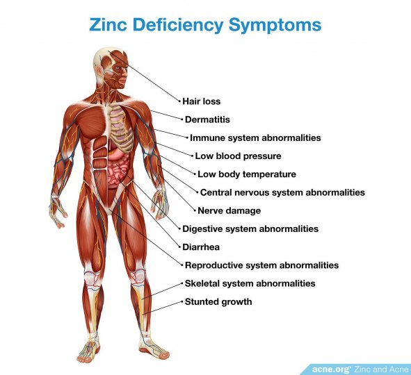 Zinc Deficiency Symptoms