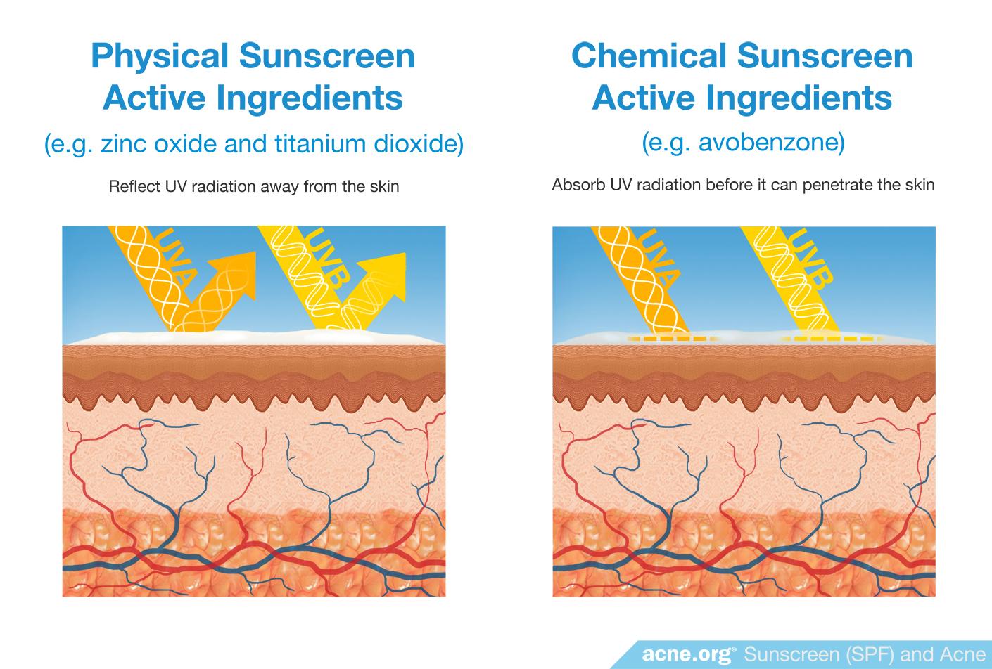 sunscreen-spf-and-acne-using-sunscreen-spf-on-acne-prone-skin