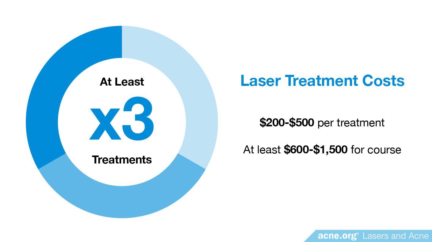 What Is The Cost For Laser Acne Treatment