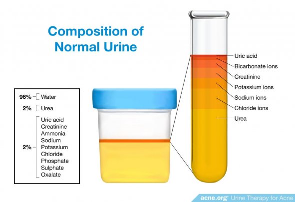 Composition of Normal Urine