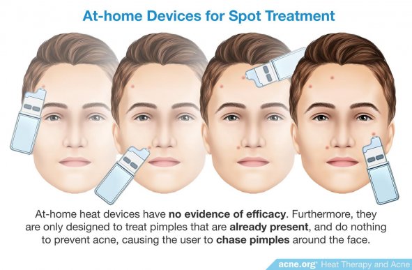 At-home Devices for Spot Treatment