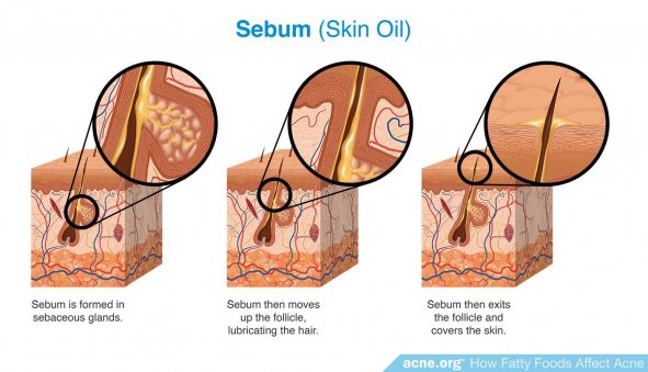 Sebum (Skin Oil)
