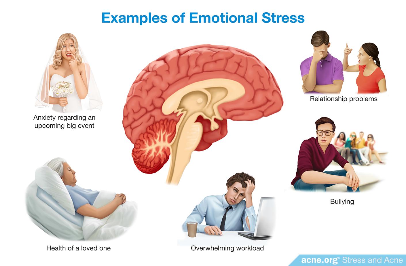 Examples of Emotional Stress