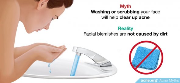 Myth: Washing or scrubbing your face will help clear up acne