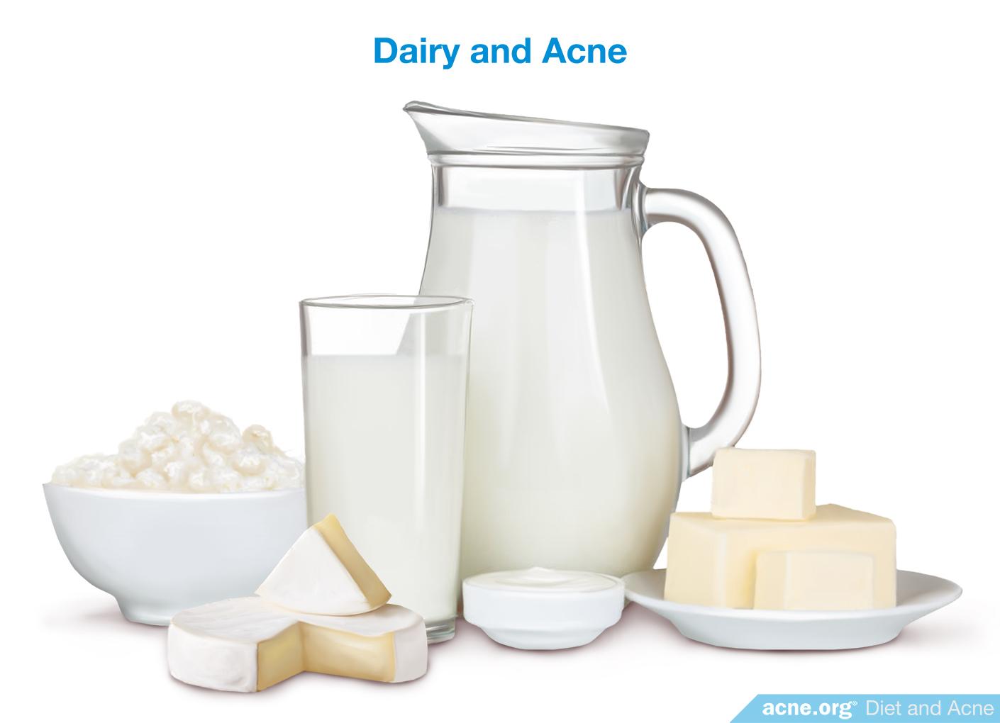 Dairy and Acne