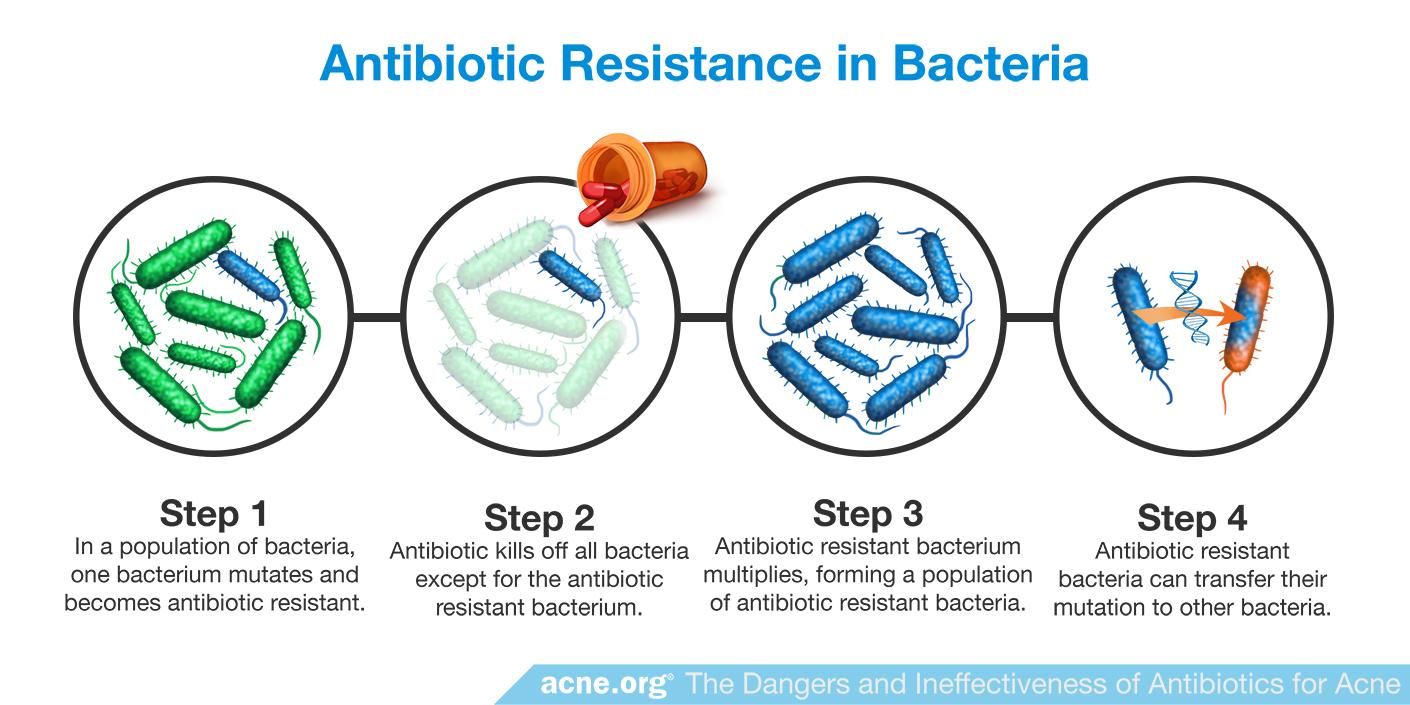 Erythromycin Antibiotic Resistance