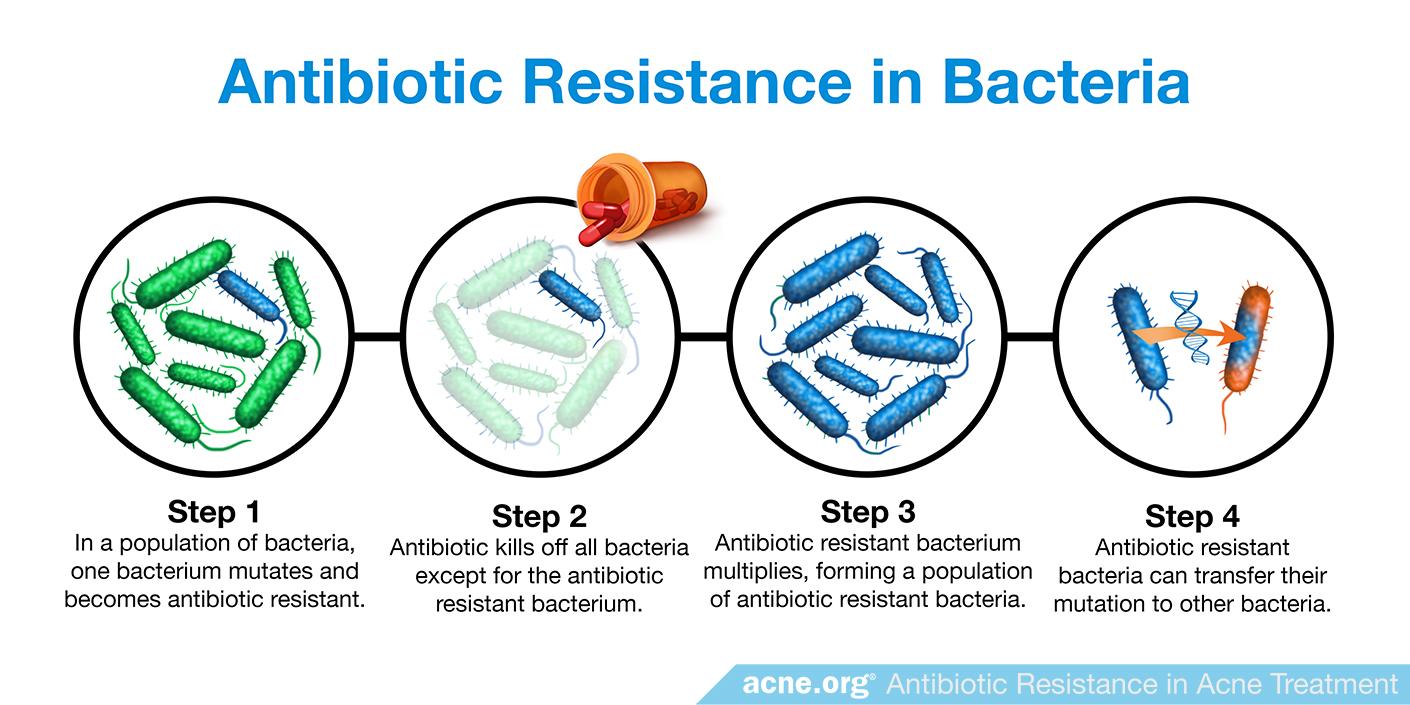 Antibiotic Resistance In Acne Treatment - Acne.org