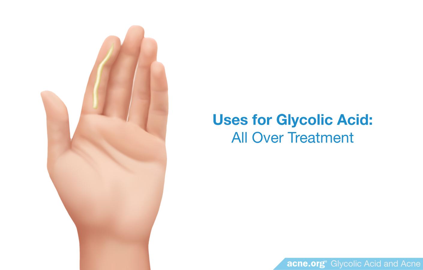 Uses for Glycolic Acid: All Over Treatment
