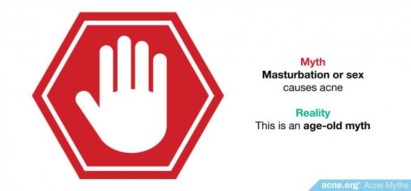 Myth: masturbation or sex causes acne