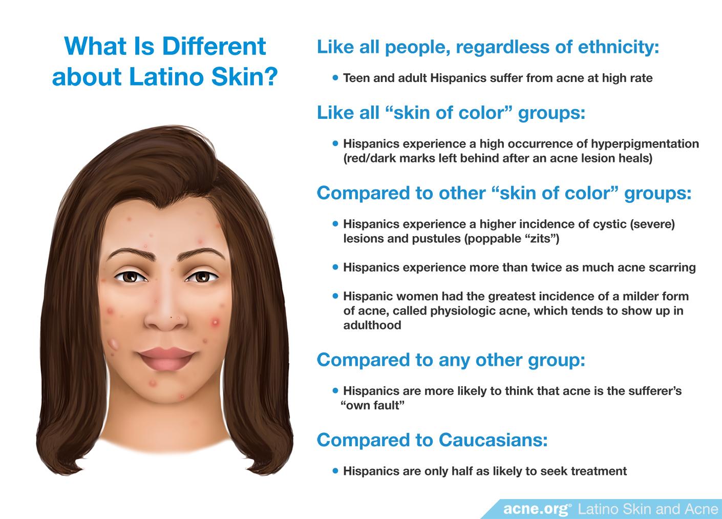 What Is Different about Latino Skin?