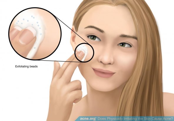 Exfoliating Beads