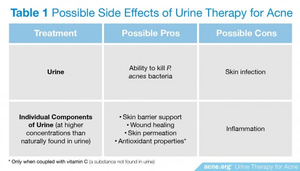 Possible Side Effects of Urine Therapy for Acne