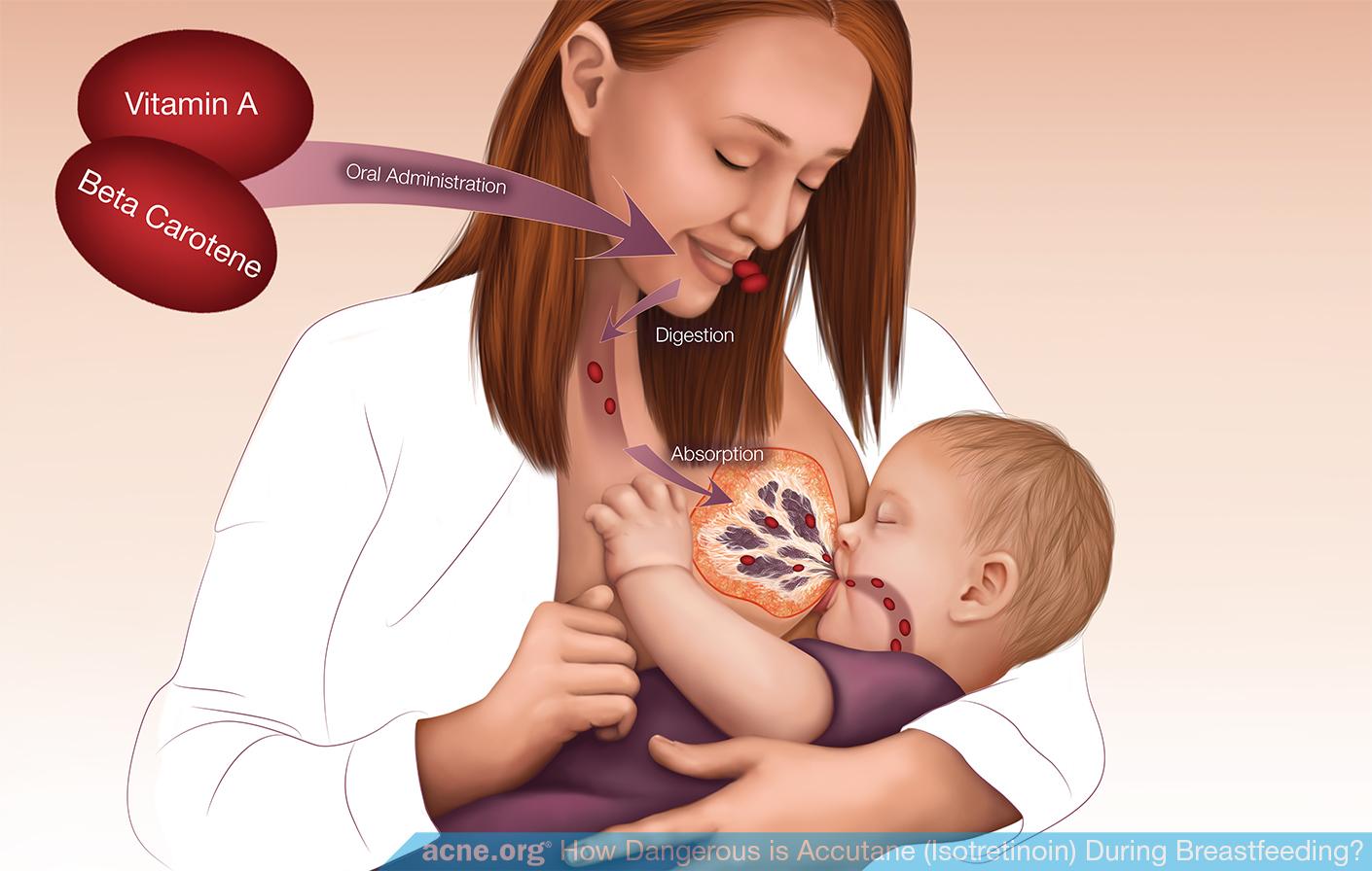 Vitamin A and Beta-Carotene Entrance into Breast Milk