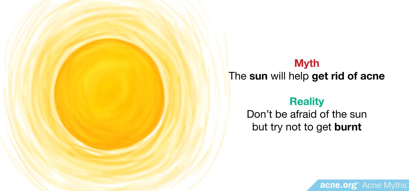 Myth: the sun will help get rid of acne