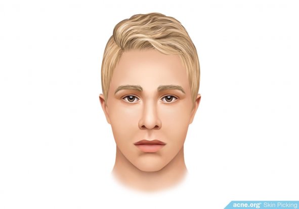 Acne-free Skin