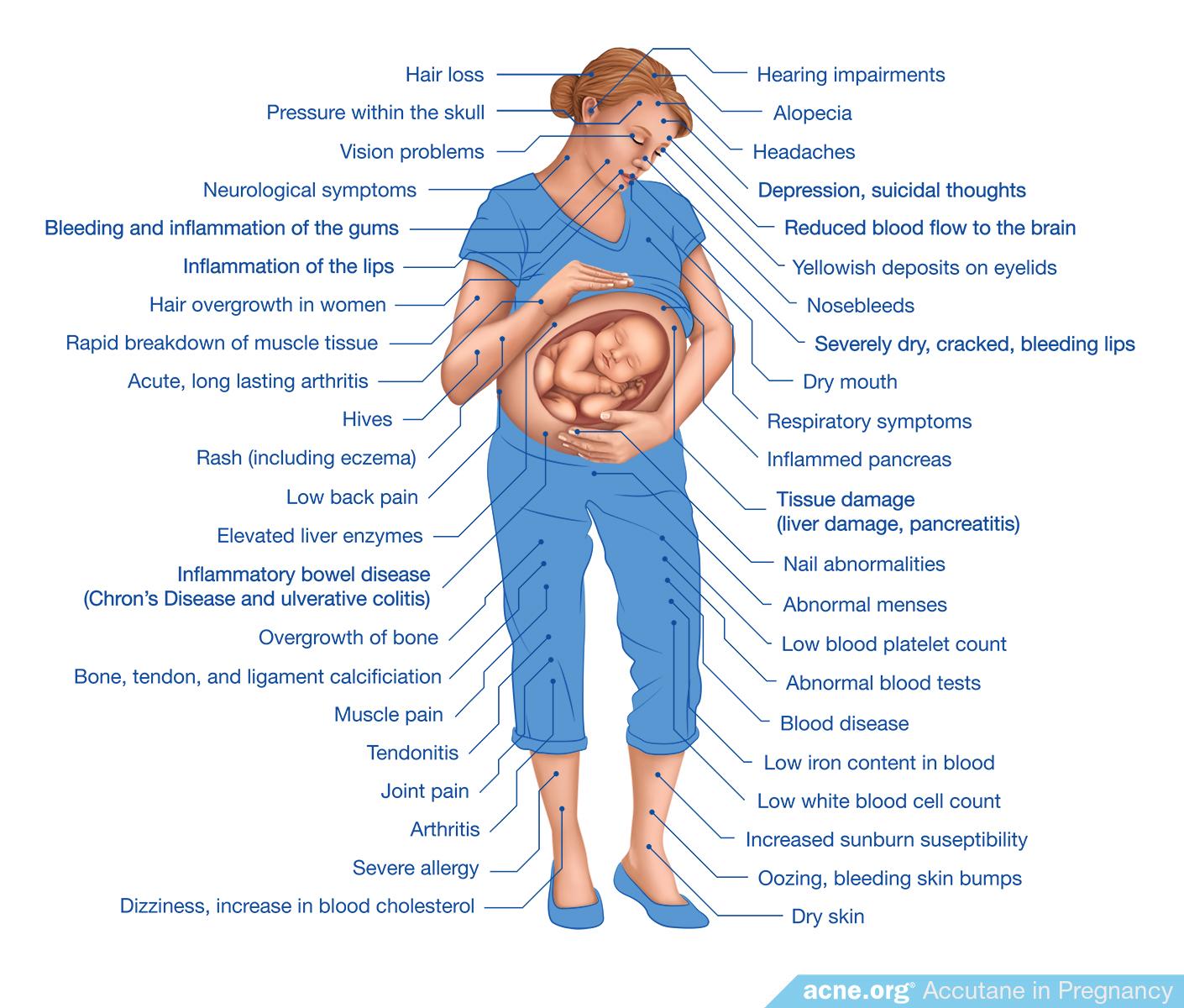 What Are The Side Effects Of Nifedipine While Pregnant