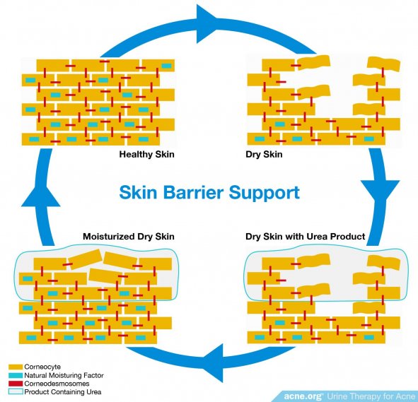 Skin Barrier Support
