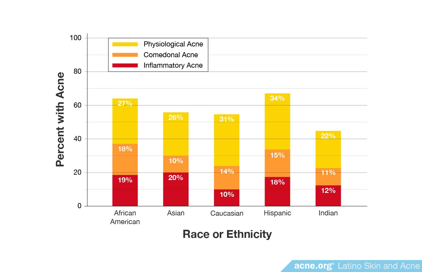 Percentage of Different Types of Acne by Ethnicity