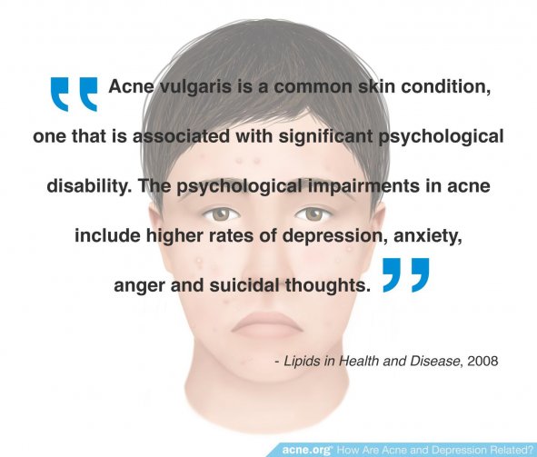 How Are Acne and Depression Related?