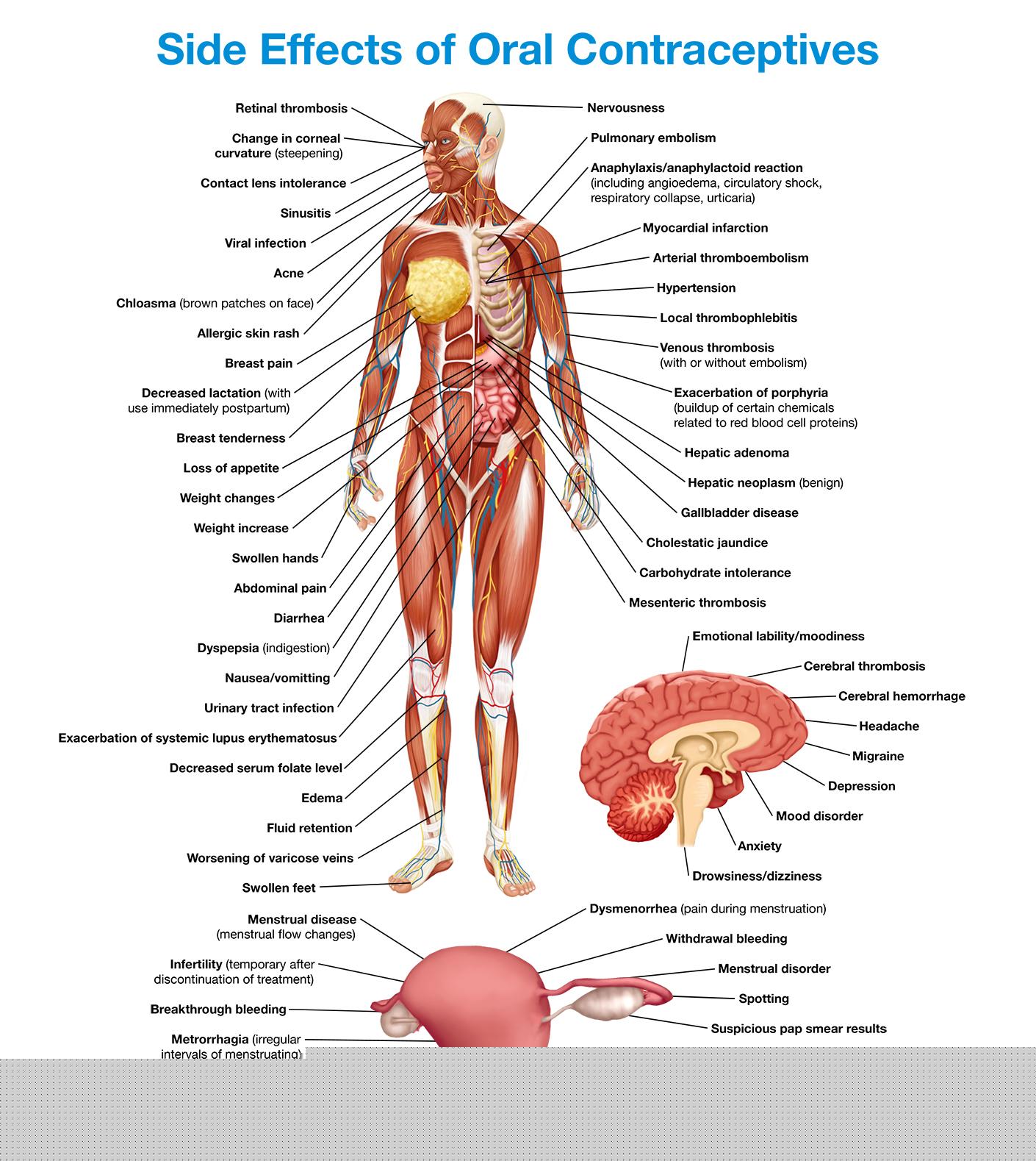 Premenstrual Acne