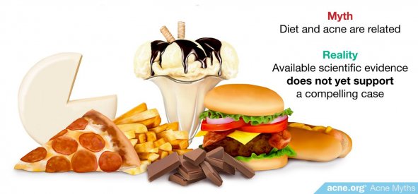 Myth: diet and acne are related
