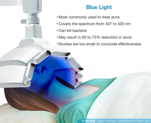 Light Therapy - Blue Light