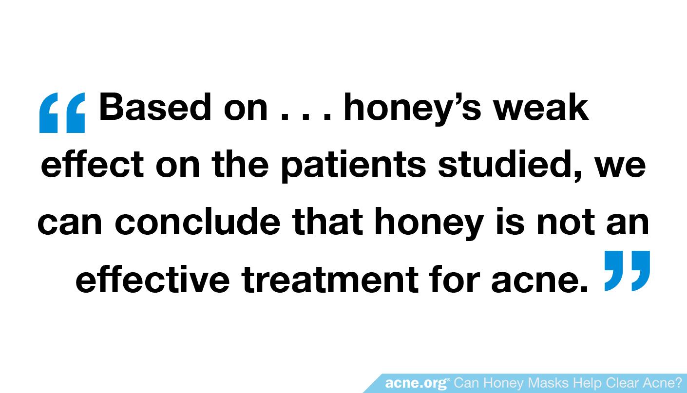 Quote: "...honey is not an effective treatment for acne"