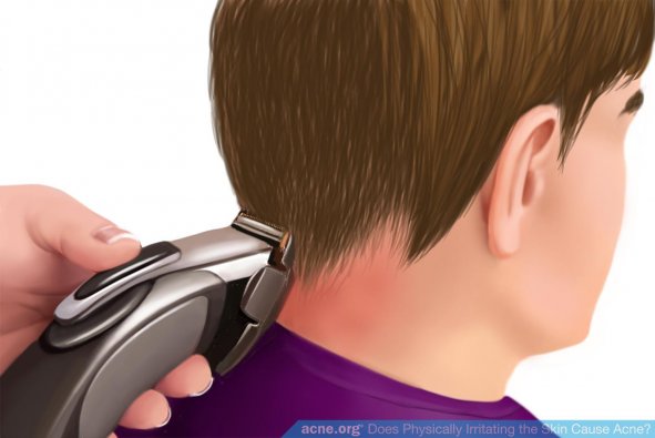 Shaving Back of Neck