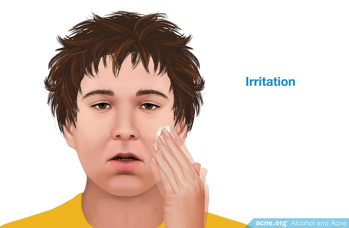 Irritation