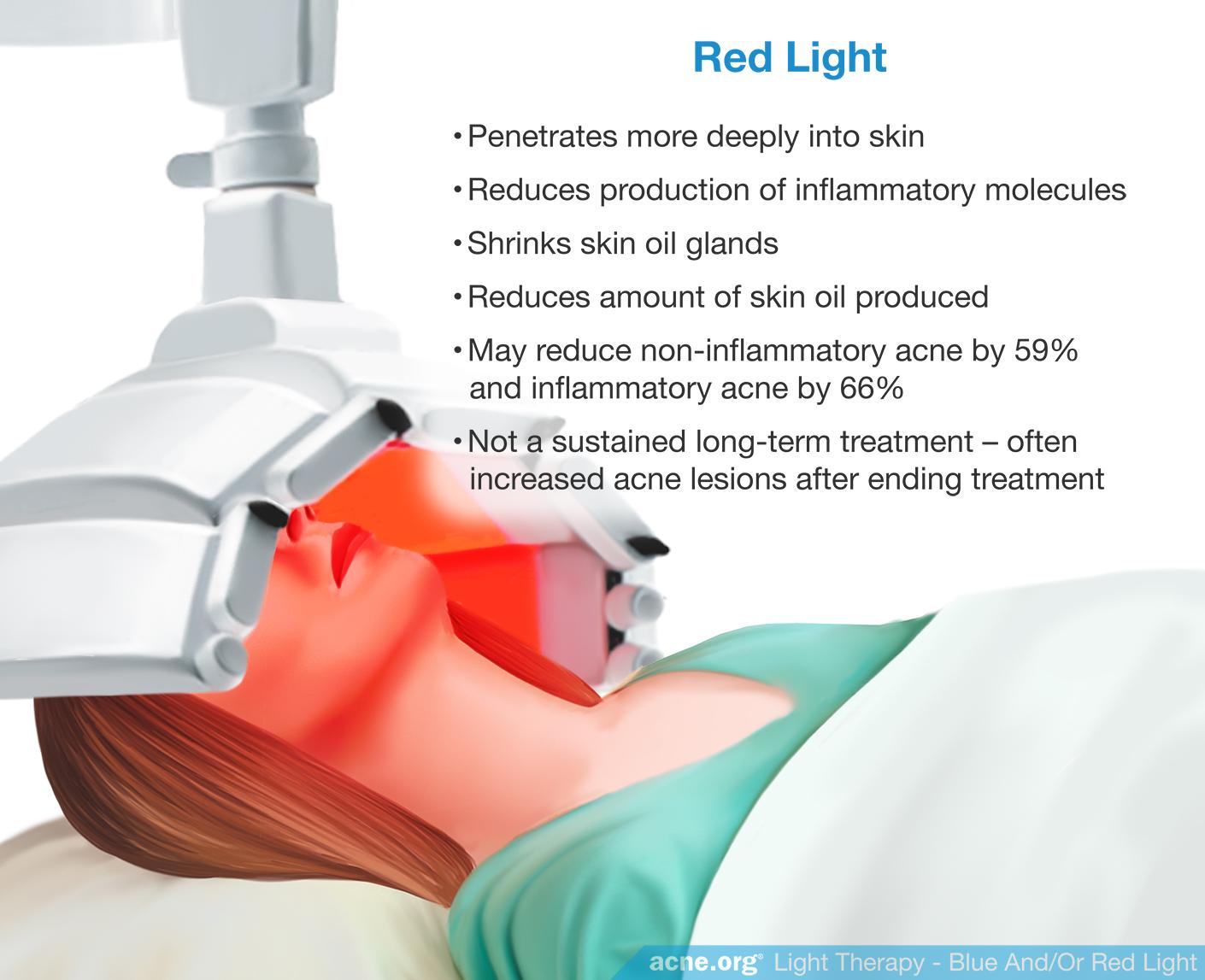 Do Blue and Red Light Devices Work to Clear Acne?