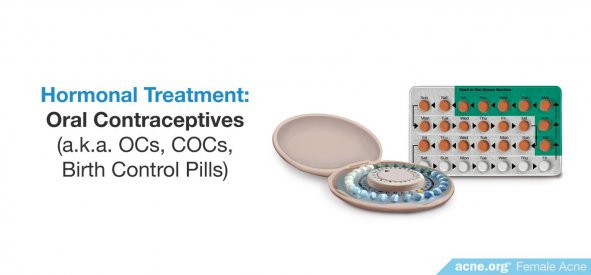 Hormonal Acne Treatment: Oral Contraceptives