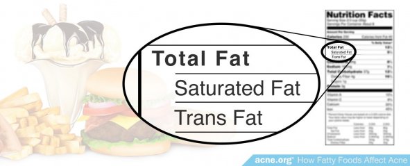 High-calorie Content of Fatty Foods