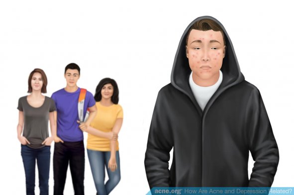 How Are Acne and Depression Related?