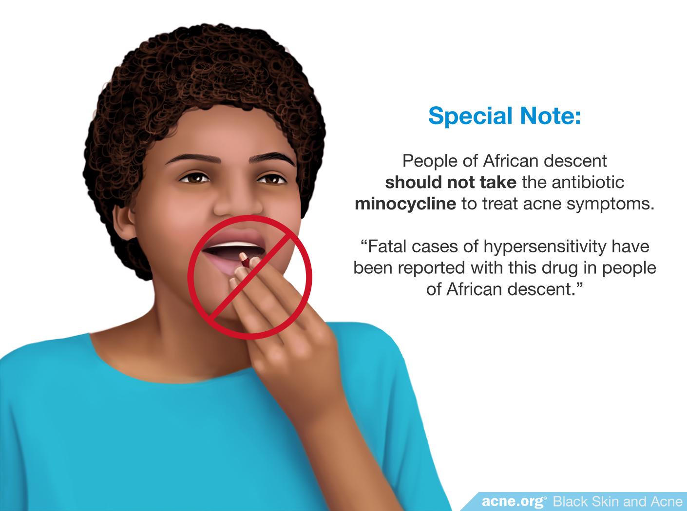 Precaution Regarding Minocycline for People of African Descent