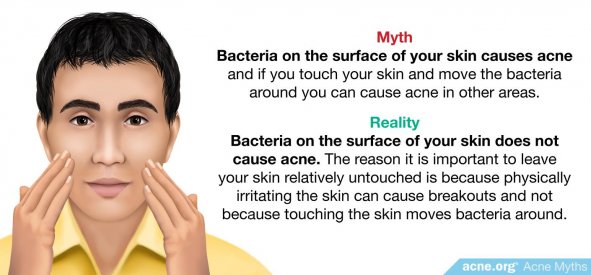 Myth: bacteria on the surface of your skin causes acne