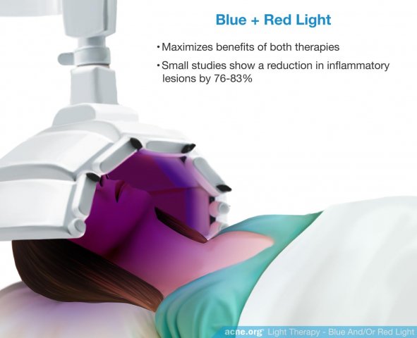 Light Therapy - Blue and Red Light