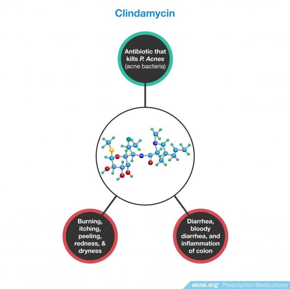 Clindamycin Effects/Side Effects