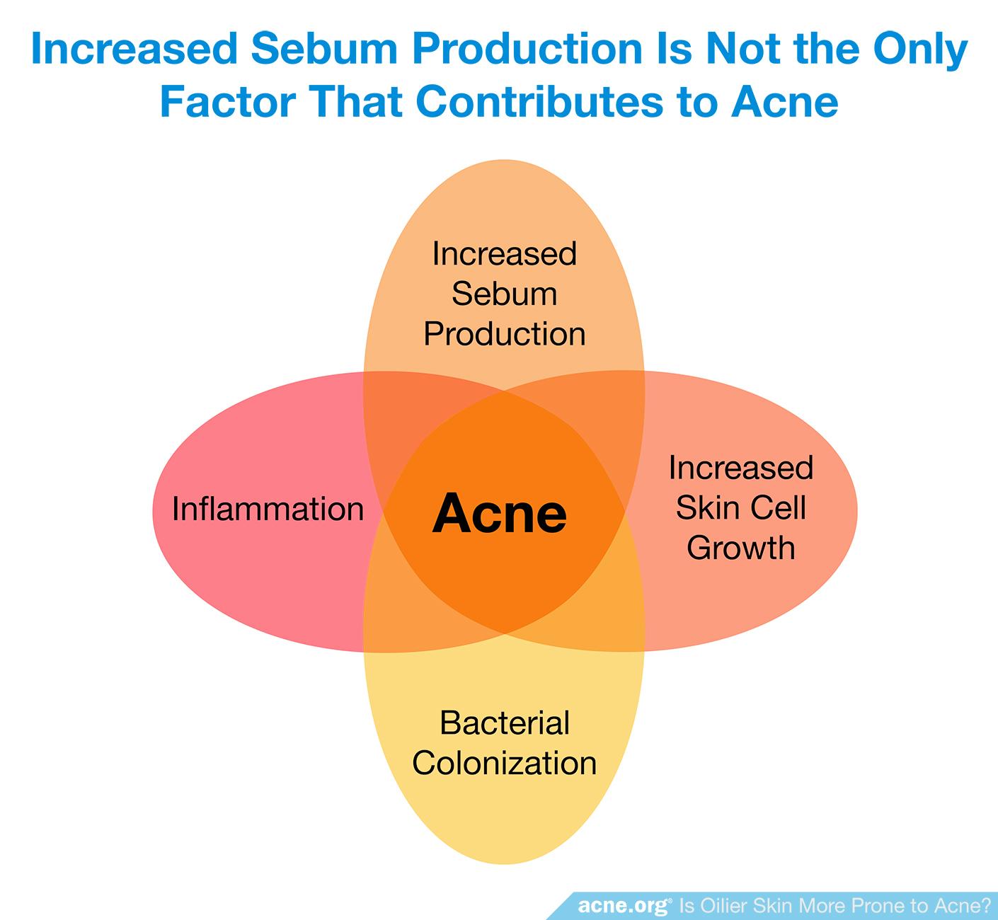 Increased Sebum Production Is Not the Only Factor that Contributes to Acne