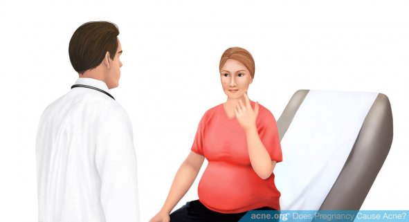 Talk to Your Doctor About Acne Treatment During Pregnancy