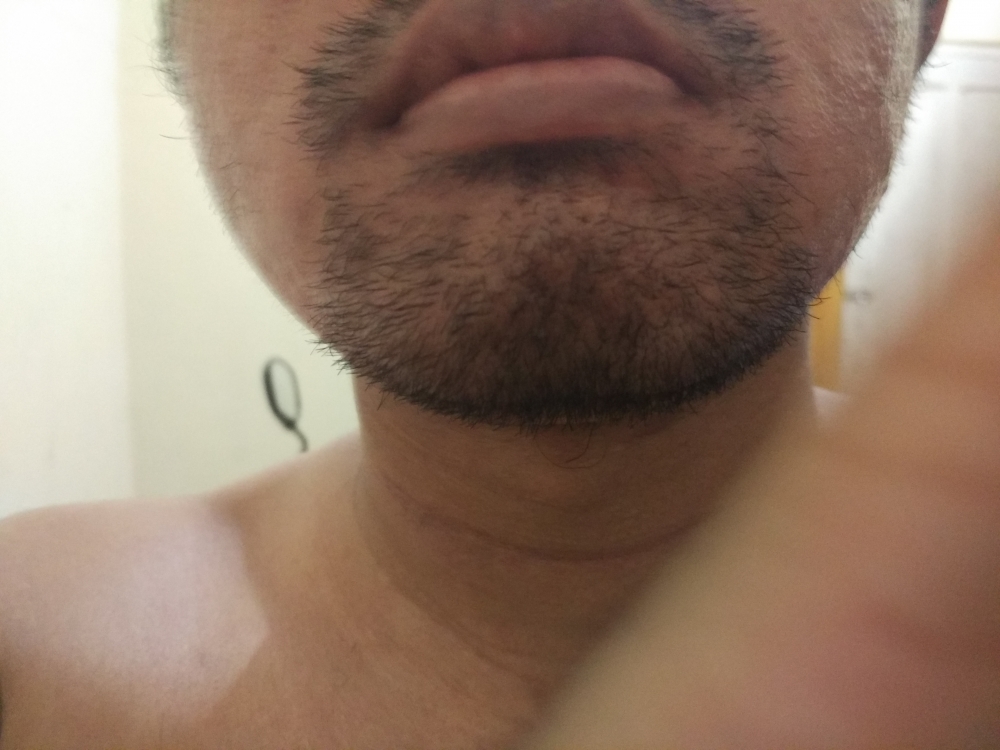 IMG_20180324_223901.jpg