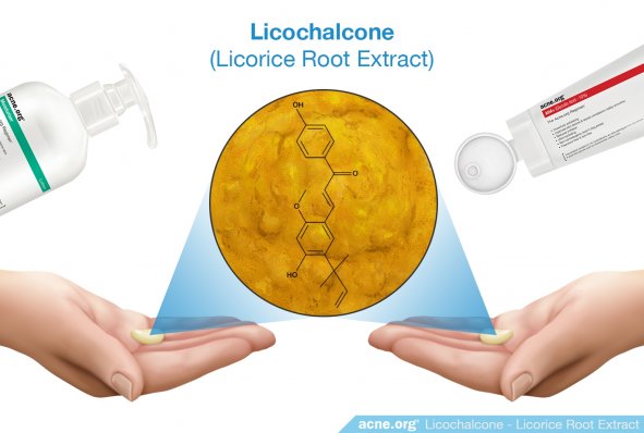 Licochalcone - A Key Ingredient in Acne.org Moisturizer and Acne.org AHA+