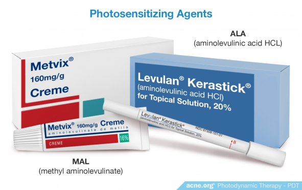 Photosensitizing Agents - Acne.org
