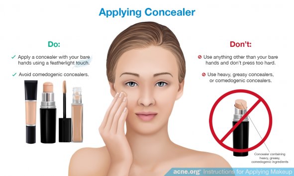 Applying Concealer to Acne-prone Skin