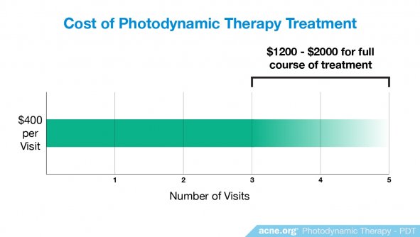 Cost of Photodynamic Therapy - Acne.org